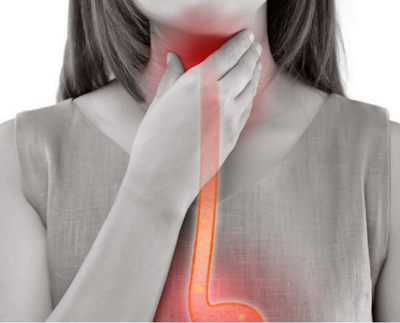 Lower Esophageal Sphincter