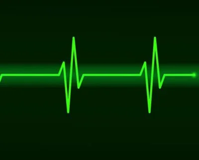 Sick Sinus Syndrome