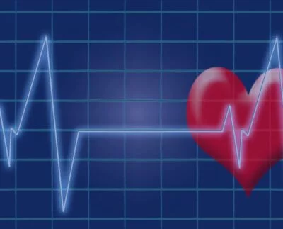 respiratory sinus arrhythmia